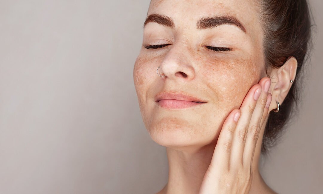 Brighten and Refresh: Benefits of IPL for Pigmentation