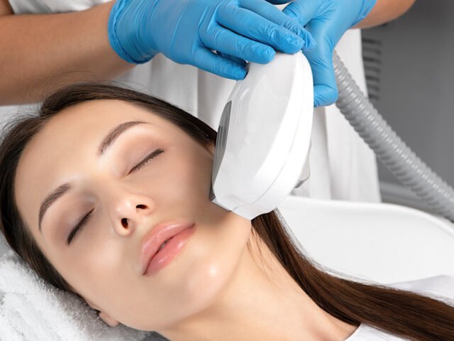 How IPL Therapy Helps Reduce Rosacea Symptoms