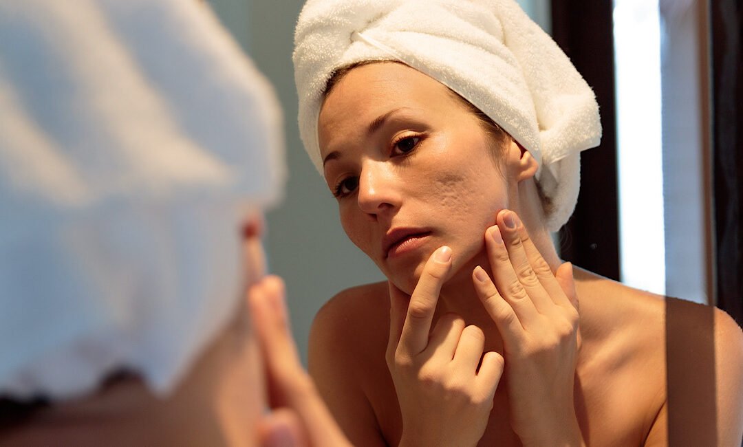 Scar Repair Method: A Targeted Solution for Stubborn Scars