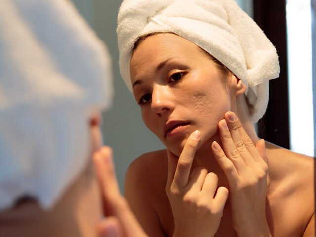 Scar Repair Method: A Targeted Solution for Stubborn Scars